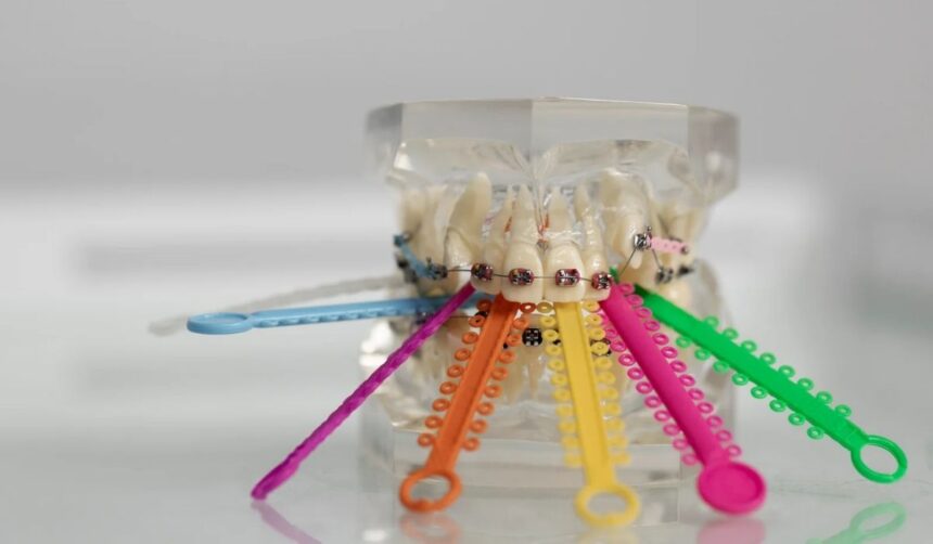 Sims 4 Rainbow Braces MagicBot