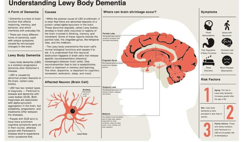 lewy body dementia