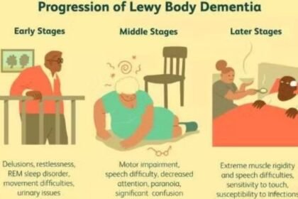 lewy body dementia