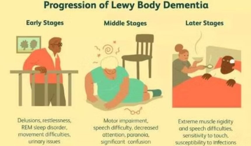lewy body dementia