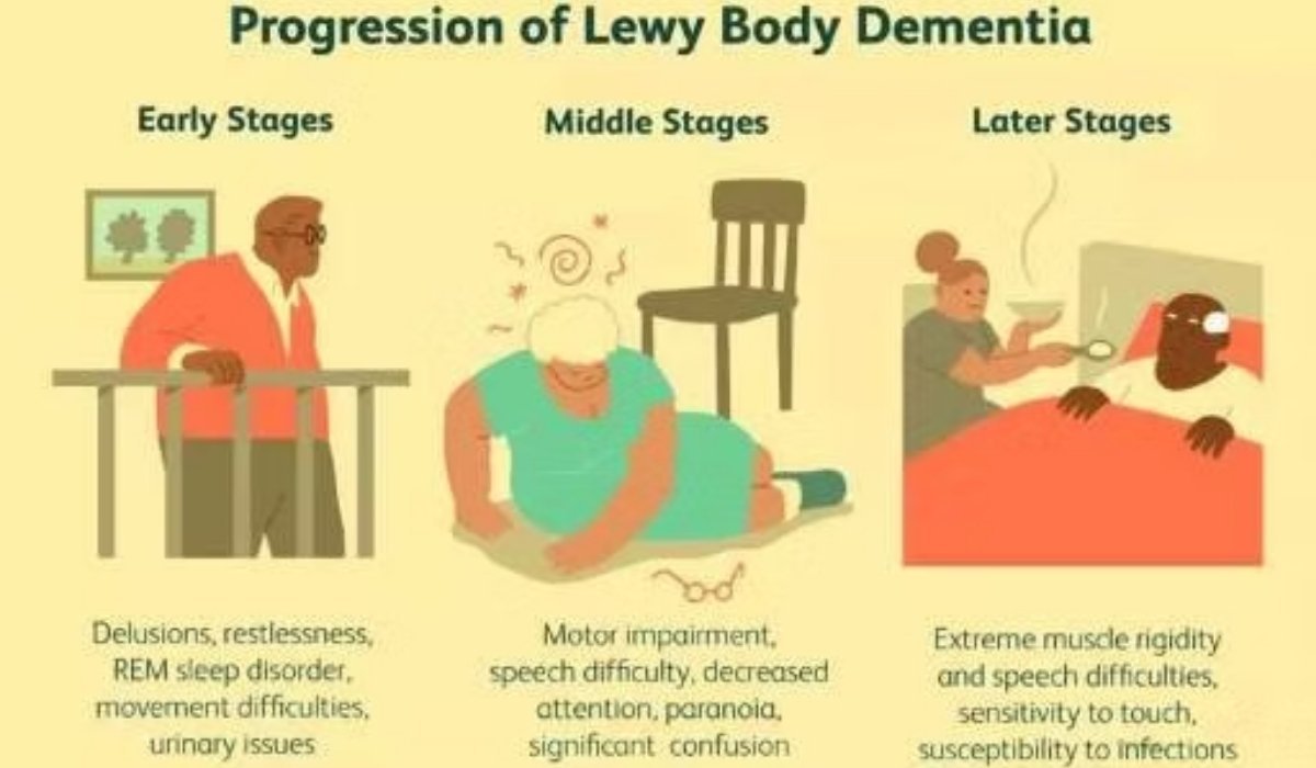 lewy body dementia
